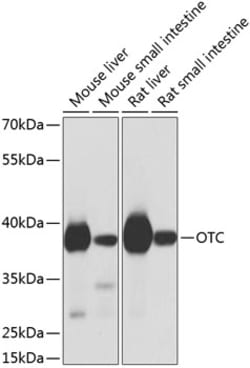 Invitrogen OTC Polyclonal Antibody 100 &mu;L; Unconjugated:Antibodies,