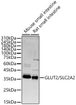 Invitrogen GLUT2 Polyclonal Antibody 100 &mu;L; Unconjugated:Antibodies,