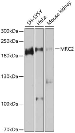 Invitrogen MRC2 Polyclonal Antibody 100 &mu;L | Buy Online | Invitrogen&trade; | Fisher Scientific