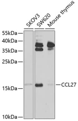 Invitrogen CCL27 Polyclonal Antibody 100 &mu;L; Unconjugated:Anticuerpos