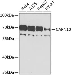 Calpain 10 Polyclonal Antibody:Antibodies, Polyclonal