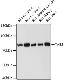 Invitrogen Tab2 Polyclonal Antibody 100 &mu;L | Buy Online | Invitrogen&trade; | Fisher Scientific