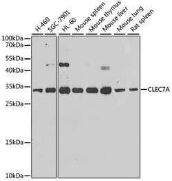 Invitrogen Dectin-1 Polyclonal Antibody 100 &mu;L; Unconjugated:Antibodies,
