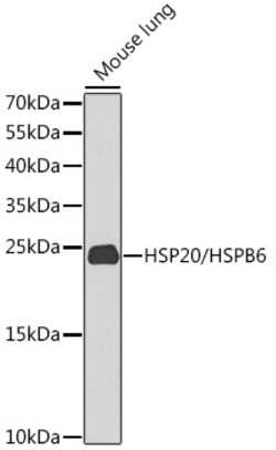Invitrogen HSP20 Polyclonal Antibody 100 &mu;L; Unconjugated:Antibodies,