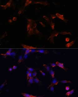 Invitrogen&trade;&nbsp;Aquaporin 5 Polyclonal Antibody
