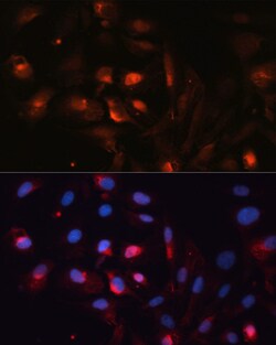 Invitrogen Aquaporin 5 Polyclonal Antibody 100 &mu;L | Buy Online | Invitrogen&trade; | Fisher Scientific