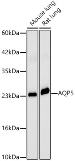 Invitrogen Aquaporin 5 Polyclonal Antibody 100 &mu;L | Buy Online | Invitrogen&trade; | Fisher Scientific