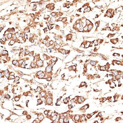 Invitrogen KIR3DS1 Polyclonal Antibody 100 &mu;L; Unconjugated:Antibodies,