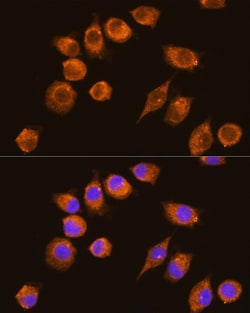 Invitrogen NAGA Polyclonal Antibody 100 &mu;L; Unconjugated:Antibodies,