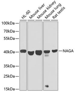 Invitrogen NAGA Polyclonal Antibody 100 &mu;L; Unconjugated:Antibodies,