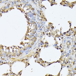 PSMB3 Polyclonal Antibody:Antibodies, Polyclonal