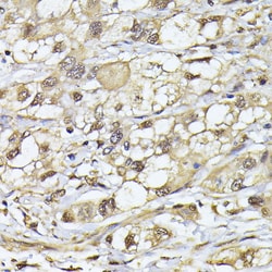 PSMB3 Polyclonal Antibody:Antibodies, Polyclonal