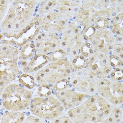 PSMB3 Polyclonal Antibody:Antibodies, Polyclonal