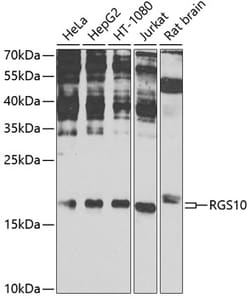 Invitrogen RGS10 Polyclonal Antibody 100 &mu;L; Unconjugated:Antibodies,
