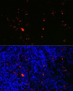 Invitrogen RNASE2 Polyclonal Antibody 100 &mu;L; Unconjugated:Antibodies,