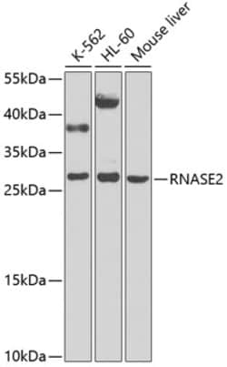 Invitrogen RNASE2 Polyclonal Antibody 100 &mu;L; Unconjugated:Antibodies,