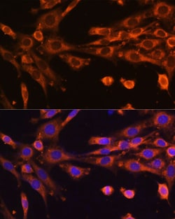 Invitrogen SUPV3L1 Polyclonal Antibody 100 &mu;L; Unconjugated:Antibodies,