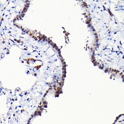 Invitrogen RGS14 Polyclonal Antibody 100 &mu;L; Unconjugated:Antibodies,