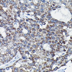 Invitrogen RGS14 Polyclonal Antibody 100 &mu;L; Unconjugated:Antibodies,