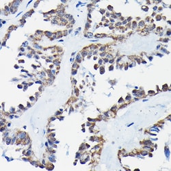 Invitrogen RGS14 Polyclonal Antibody 100 &mu;L; Unconjugated:Antibodies,