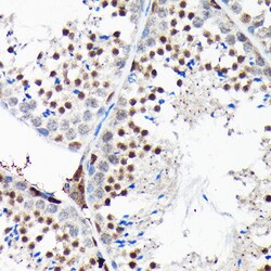Invitrogen RGS14 Polyclonal Antibody 100 &mu;L; Unconjugated:Antibodies,
