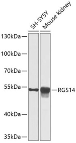 Invitrogen RGS14 Polyclonal Antibody 100 &mu;L; Unconjugated:Antibodies,