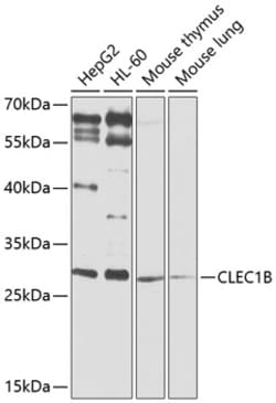 Invitrogen CLEC1B Polyclonal Antibody 100 &mu;L | Buy Online | Invitrogen&trade; | Fisher Scientific