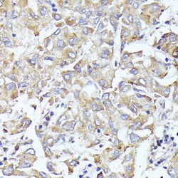 Invitrogen eIF3l Polyclonal Antibody 100 &mu;L; Unconjugated:Antibodies,