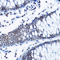 Invitrogen RPP25 Polyclonal Antibody 100 &mu;L; Unconjugated:Antibodies,