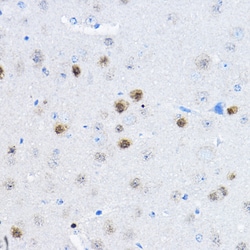 Invitrogen RPP25 Polyclonal Antibody 100 &mu;L; Unconjugated:Antibodies,