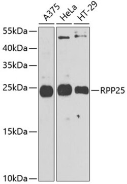 Invitrogen RPP25 Polyclonal Antibody 100 &mu;L; Unconjugated:Antibodies,