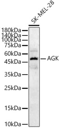 Invitrogen AGK Polyclonal Antibody 100 &mu;L; Unconjugated:Antibodies,