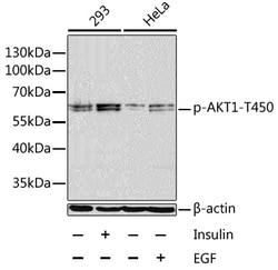 Invitrogen Phospho-AKT1 (Thr450) Polyclonal Antibody 100 &mu;L; Unconjugated:Antibodies,