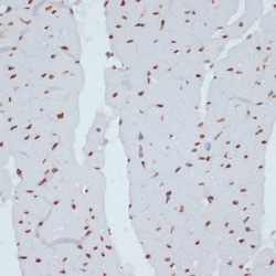 Invitrogen Phospho-Chk1 (Ser280) Polyclonal Antibody 100 &mu;L; Unconjugated:Antibodies,