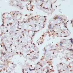Invitrogen Phospho-Chk1 (Ser280) Polyclonal Antibody 100 &mu;L; Unconjugated:Antibodies,