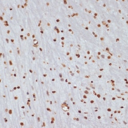 Invitrogen Phospho-Chk1 (Ser280) Polyclonal Antibody 100 &mu;L; Unconjugated:Antibodies,