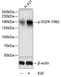 Phospho-EGFR (Tyr992) Polyclonal Antibody:Antibodies, Polyclonal