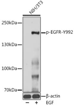 Phospho-EGFR (Tyr992) Polyclonal Antibody:Antibodies, Polyclonal
