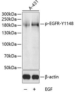Phospho-EGFR (Tyr1148) Polyclonal Antibody 100 &mu;L | Buy Online | Thermo Scientific | Fisher Scientific