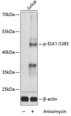 Phospho-ELK1 (Ser383) Polyclonal Antibody:Antibodies, Polyclonal