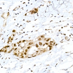 Invitrogen Phospho-Rb (Ser795) Polyclonal Antibody 100 &mu;L; Unconjugated:Antibodies,
