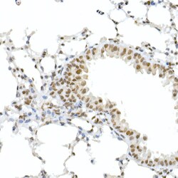 Invitrogen Phospho-Rb (Ser795) Polyclonal Antibody 100 &mu;L; Unconjugated:Antibodies,