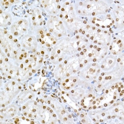 Invitrogen Phospho-Rb (Ser795) Polyclonal Antibody 100 &mu;L; Unconjugated:Antibodies,