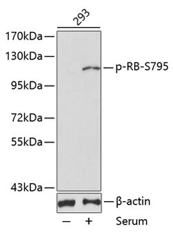 Invitrogen Phospho-Rb (Ser795) Polyclonal Antibody 100 &mu;L; Unconjugated:Antibodies,