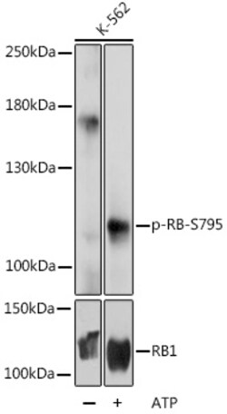 Invitrogen Phospho-Rb (Ser795) Polyclonal Antibody 100 &mu;L; Unconjugated:Antibodies,