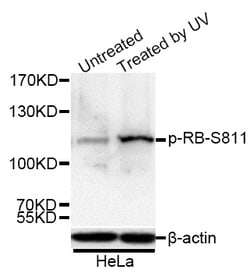 Phospho-Rb (Ser811) Polyclonal Antibody:Antibodies, Polyclonal