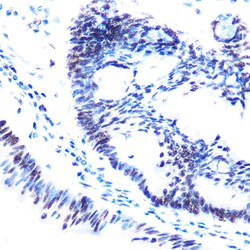 Invitrogen Phospho-SMC1 (Ser957) Polyclonal Antibody 100 &mu;L; Unconjugated:Antibodies,