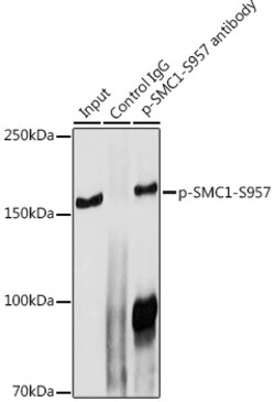 Invitrogen Phospho-SMC1 (Ser957) Polyclonal Antibody 100 &mu;L; Unconjugated:Antibodies,