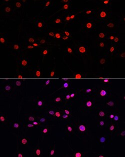 Invitrogen Phospho-Histone H3 (Thr11) Polyclonal Antibody 100 &mu;L; Unconjugated:Antibodies,