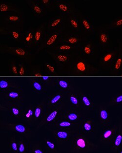 Invitrogen Phospho-Histone H3 (Thr11) Polyclonal Antibody 100 &mu;L; Unconjugated:Antibodies,